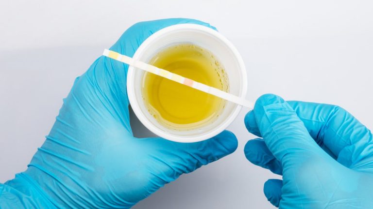 Synthetic urine